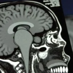 MRI scans reveal the shocking truth about teenage brain development and why kids ignore parents